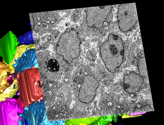 Medical Image Analysis